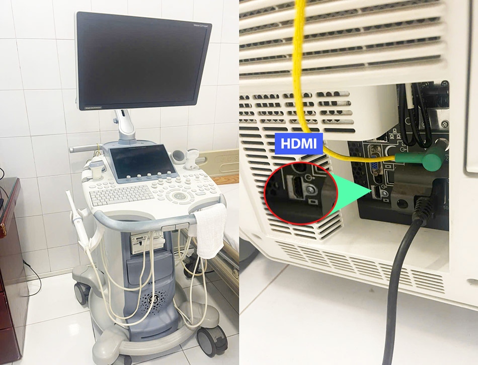 Video Capture Card Box HDMI Capture to USB 3.0 có Mic, HDMI IN OUT ghi hình, live stream camera, siêu âm, nội soi y tế